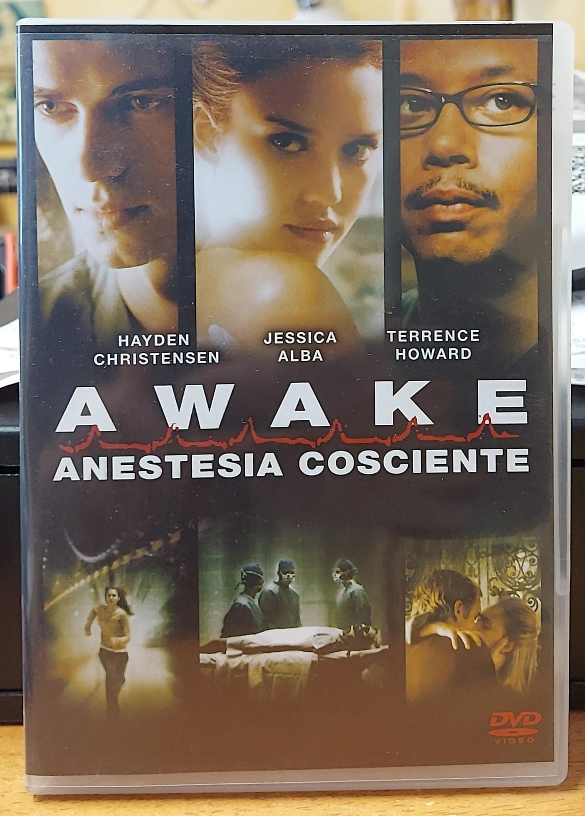 AWAKE ANESTESIA COSCIENTE